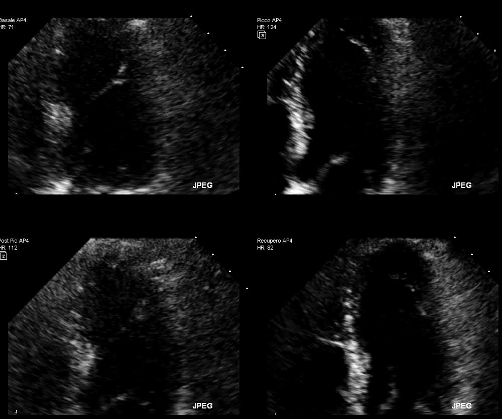 Alterazioni cinetica