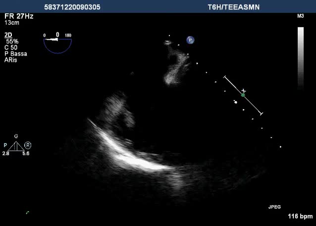 Vegetazione tricuspidale