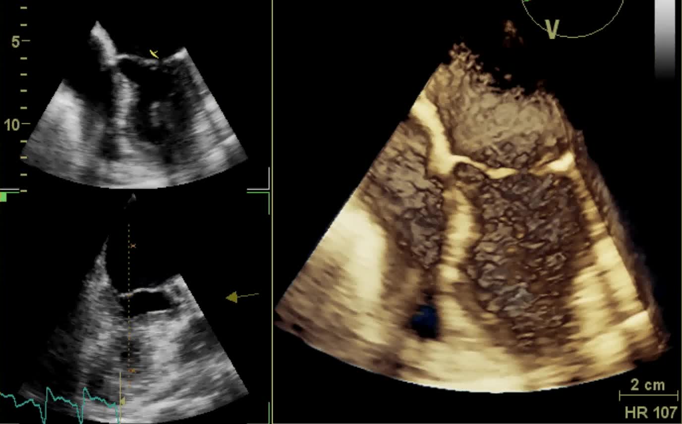 Ventricolo ed atrio di sinistra; ventricolo ed atrio di destra