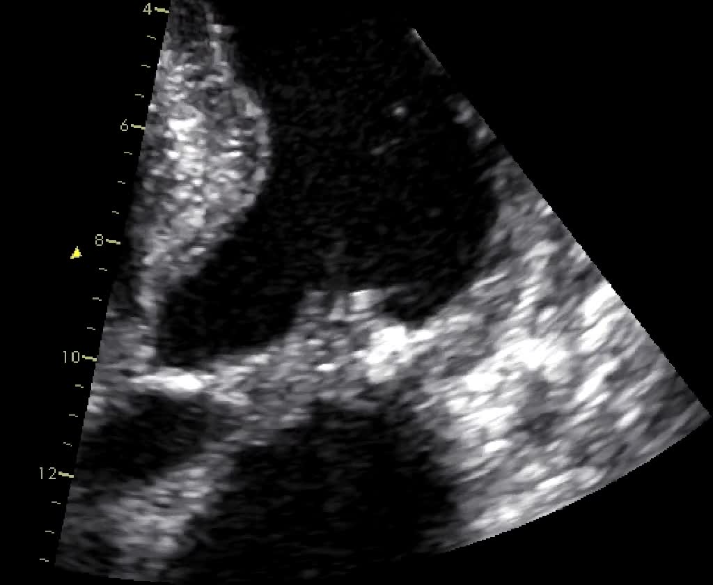 Vegetazione mitralica
