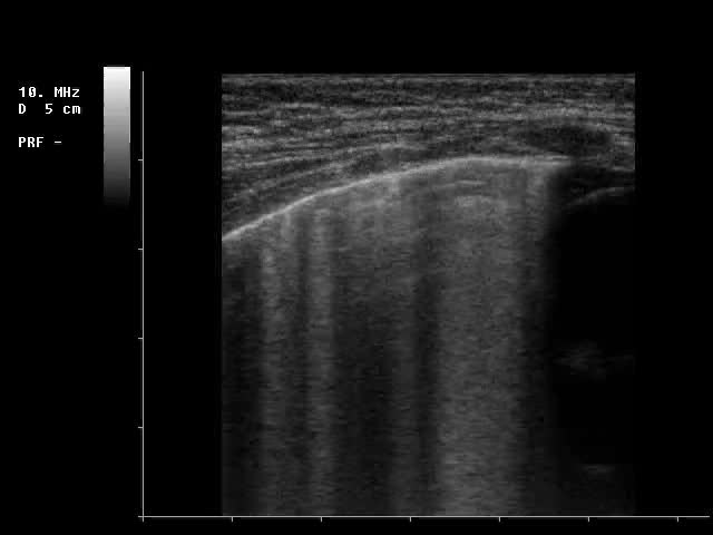 Scompenso cardio circolatorio