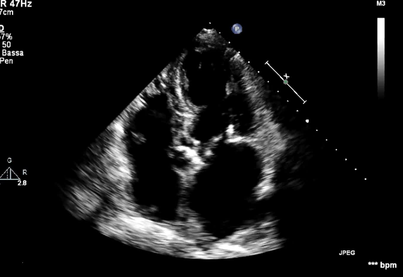 Vegetazione mitralica