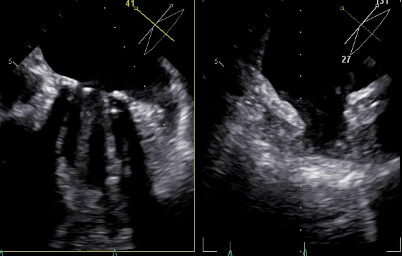 Auricola plurilobala