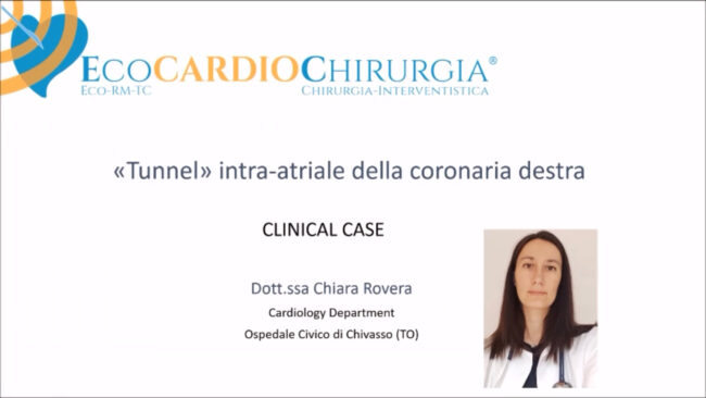 Caso Clinico Area TC Rovera dicembre 2022