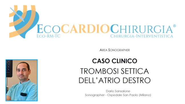 Caso Clinico Area Sonographer Sansalone febbraio 2023