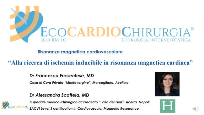 Caso Clinico Area Cardio-RMN Frecentese-Scatteia aprile 2023
